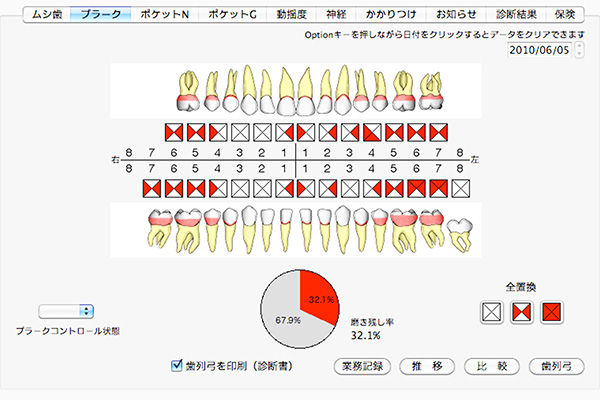 ブラッシング指導