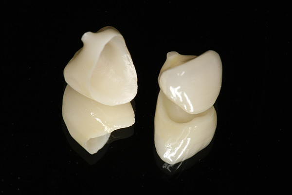 オールセラミッククラウン